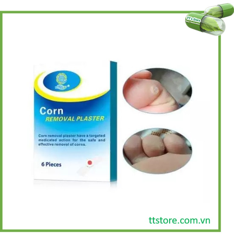 Miếng dán giảm mụn cóc Corn Removal Plaster Kangdy (Hộp 6 miếng)