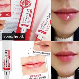 Son dưỡng môi chống thâm labocare panteno lips