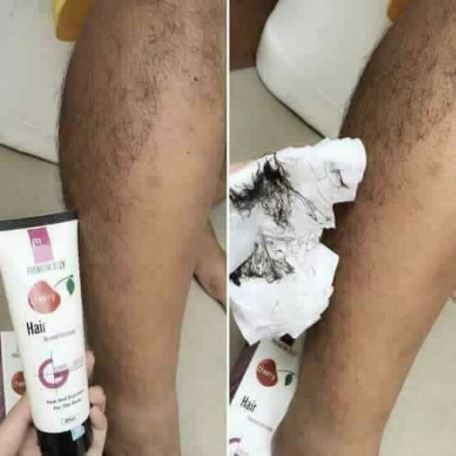 TRIỆT LÔNG TẨY LÔNG MWHITE CHÍNH HÃNG | BigBuy360 - bigbuy360.vn