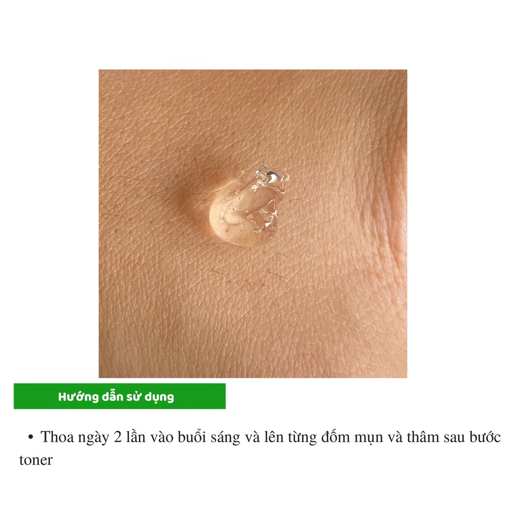 Gel Giảm Thâm Và Mụn Ẩn Gamma Megaduo 15g - 30g