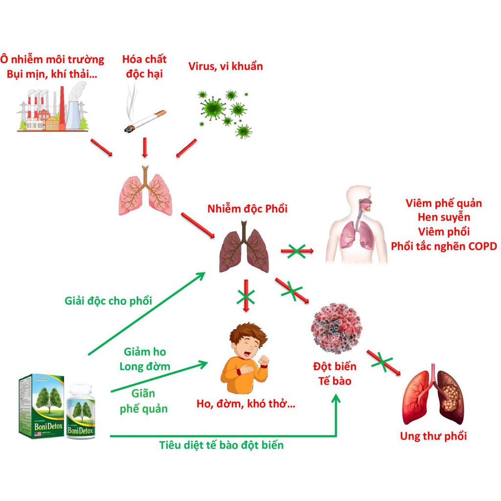 BoniDetox - Giúp Giải Độc Phổi & Ngừa Ung Thư Phổi Hộp 30 Viên