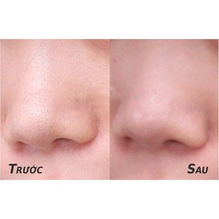 MIẾNG DÁN MŨI LỘT MỤN BIORE 4 miếng
