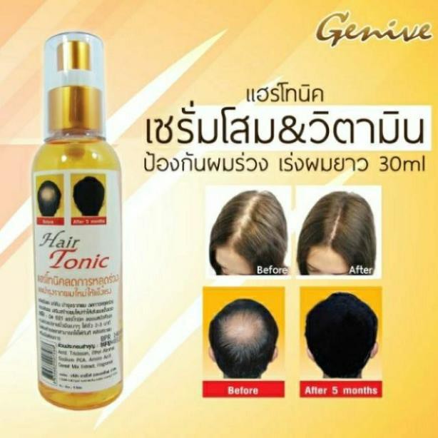 Chai Xịt Kích Thích Mọc Tóc Cho Nam GENIVE Hair Tonic 120ml - Thái Lan