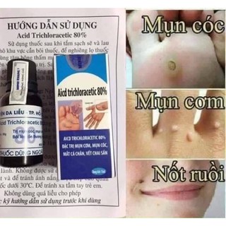 CHẤM NỐT RUỒI,MỤN CÓC CHÍNH HÃNG