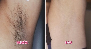Kem Tẩy Lông Balea Nội địa Đức