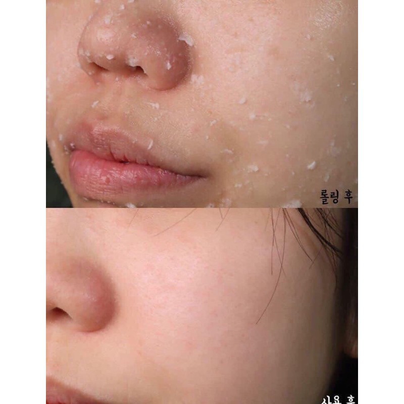 Tẩy Tế Bào Chết Innisfree Green Barley Gommage Peeling Mask Chiết Xuất Từ Lúa Mạch 120ml | BigBuy360 - bigbuy360.vn