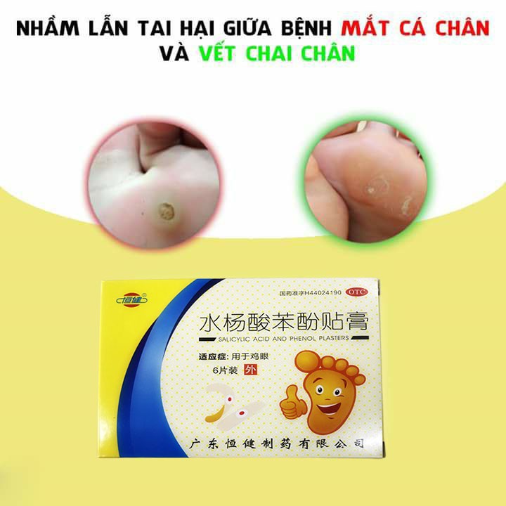 [CHÍNH HÃNG] Miếng dán mụn cóc, mắt cá chân, chai chân, mụn cơm, an toàn, hiệu quả