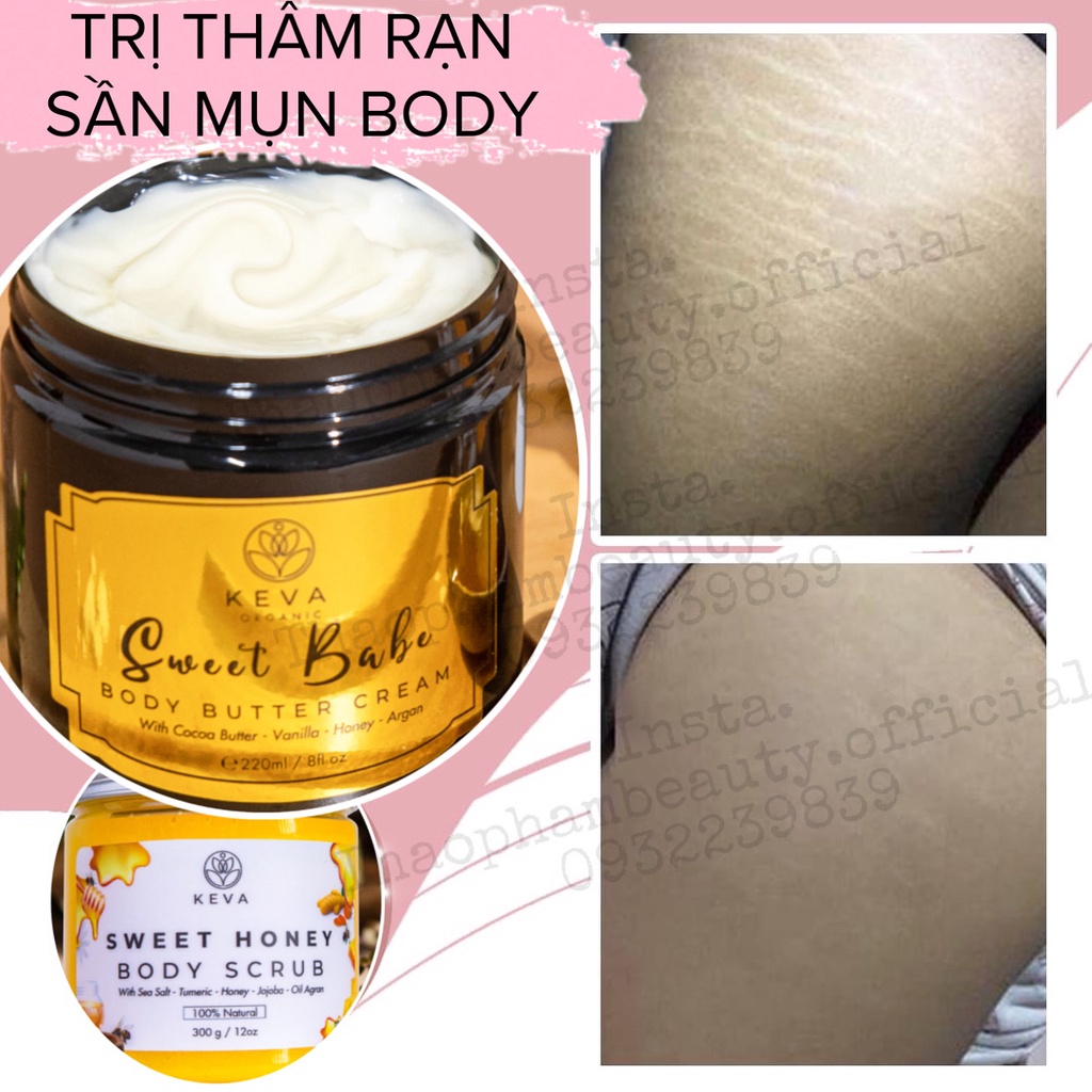 Kem làm mờ thâm vùng dưới cánh tay/đầu gối, dưỡng trắng da body Retinol Butter Cream Sweet Baby 220ml – Thảo Phạm Beauty