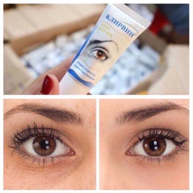 Kem Klirvint Nga | BigBuy360 - bigbuy360.vn