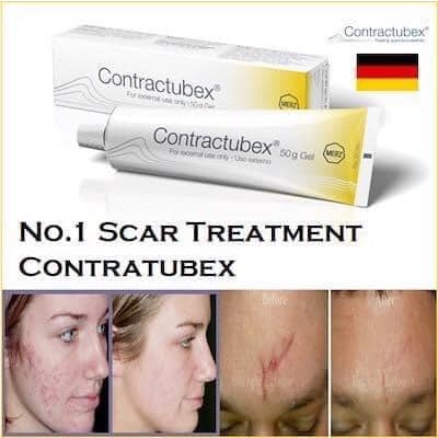 Kem làm mờ sẹo CONTRACTUBEX 30g