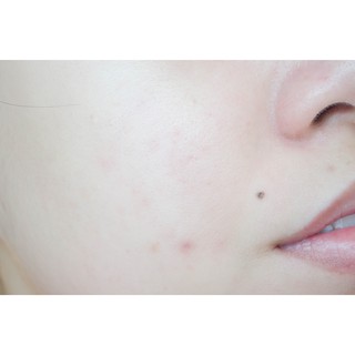Serum cấp nước 9wishes HYDRA SKIN AMPULE SERUM