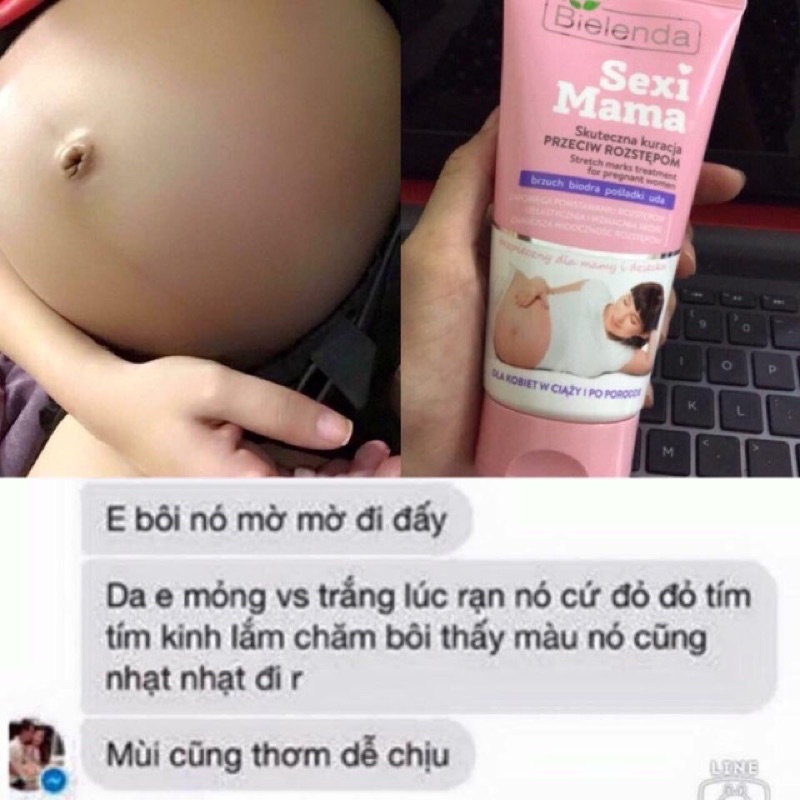 nội địa Ba Lan - kem phòng ngừa và tr ị rạn da Bielenda Sexy Mama