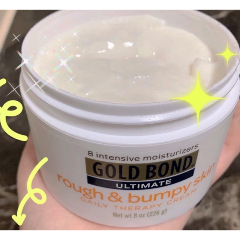 Kem Dưỡng Gold Bond Ultimate Rough & Bumpy Skin
