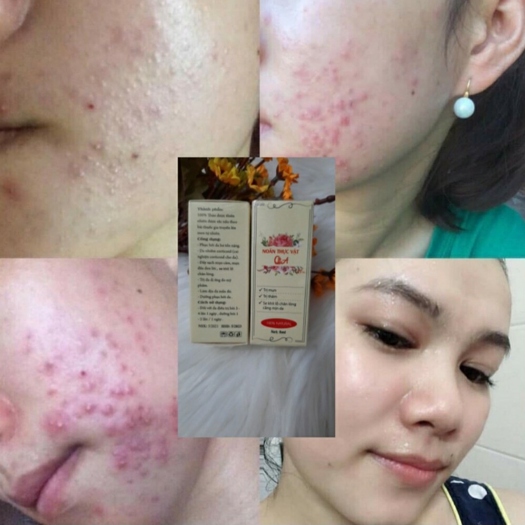 Serum đường đen