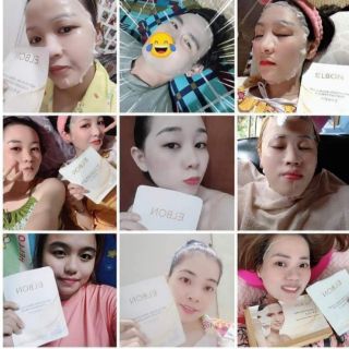 MẶT NẠ DƯỠNG TRẮNG DA ELBON