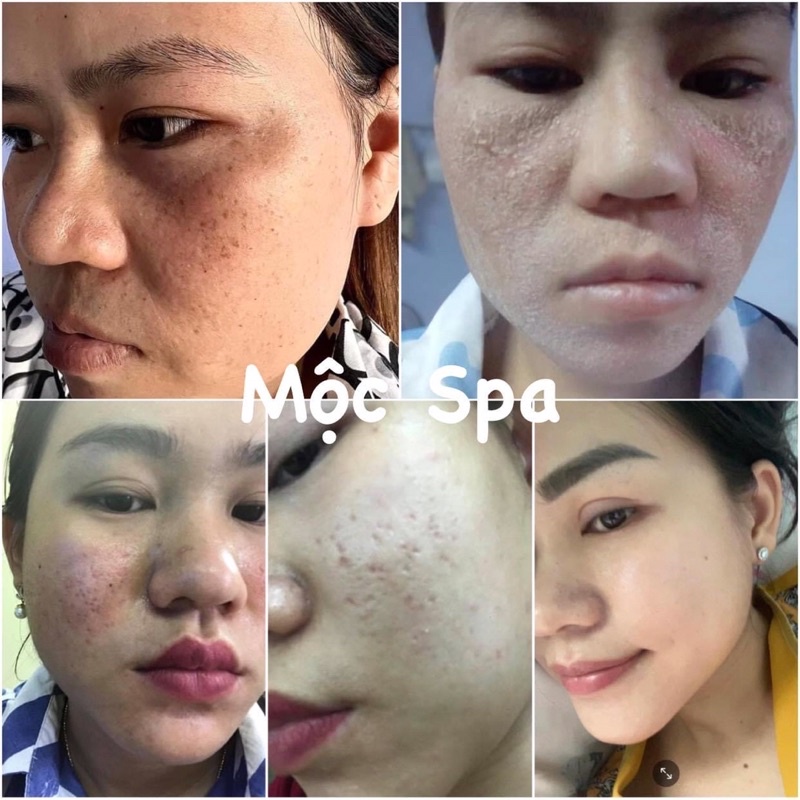 Tinh chất lành tính