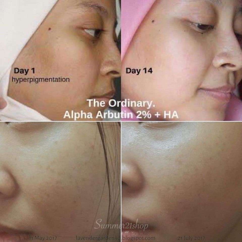 Tinh Chất Dưỡng Trắng, Cấp Nước The Ordinary Alpha Arbutin 2% + HA 30ml