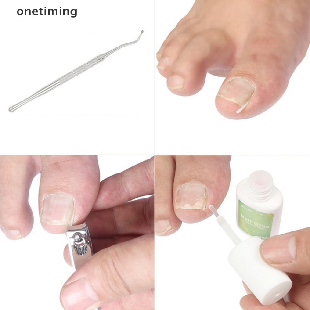 Đệm Silicone Hỗ Trợ Định Hình Móng Tay