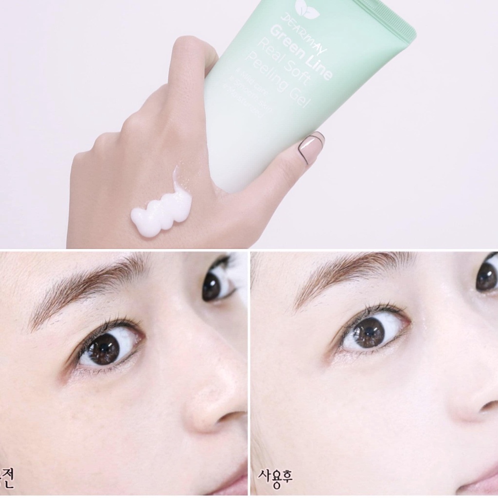 TẨY TẾ BÀO CHẾT DẠNG GEL DEARMAY GREEN LINE REAL SOFT PEELING 150ML CHÍNH HÃNG - 9816