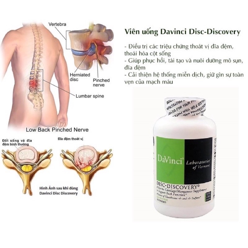 Viên Uống Disc Discovery Davinci 180 Viên Hỗ Trợ Thoát Vị Đĩa Đệm Thoái Hóa Cột Sống