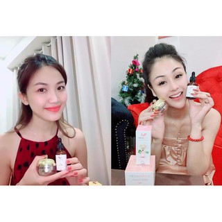 Kem Dưỡng Da MeraWhite - Trắng Da, Mờ Thâm Nám