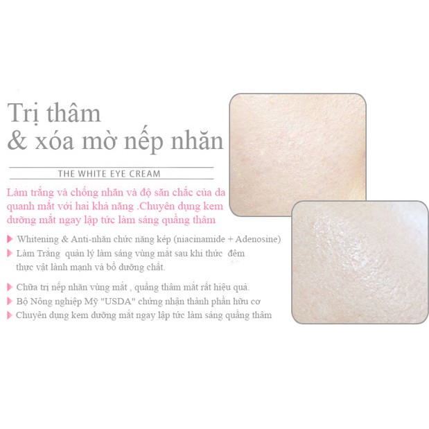 Kem dưỡng giảm thâm mắt Milky Dress xóa nếp nhăn dưới mắt The White Eye Cream 15ml