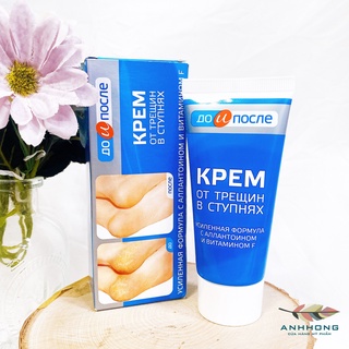 Kem Dưỡng Nứt Gót Chân Nga Kpem