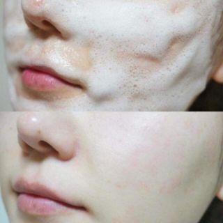 Sữa rửa mặt gạo ý dĩ Hatomugi