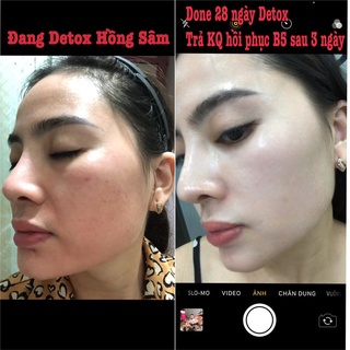 Detox Hồng Sâm DR CELL 50ml tái tạo da mờ thâm nám giảm mụn