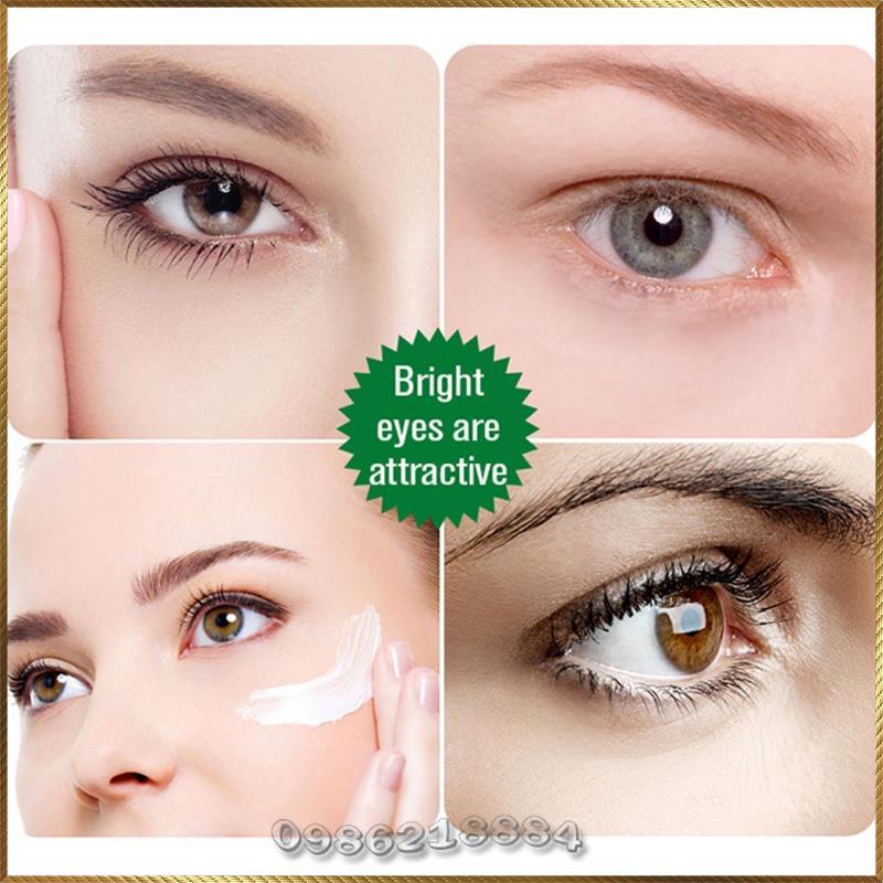 Kem giảm thâm quầng mắt Aichun xóa nếp nhăn dưỡng ẩm chuyên sâu A5571