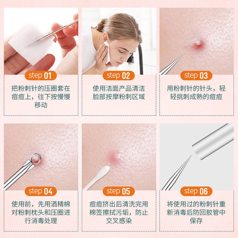 Dụng Cụ Loại Bỏ Mụn Đầu Đen Cầm Tay Tiện Lợi