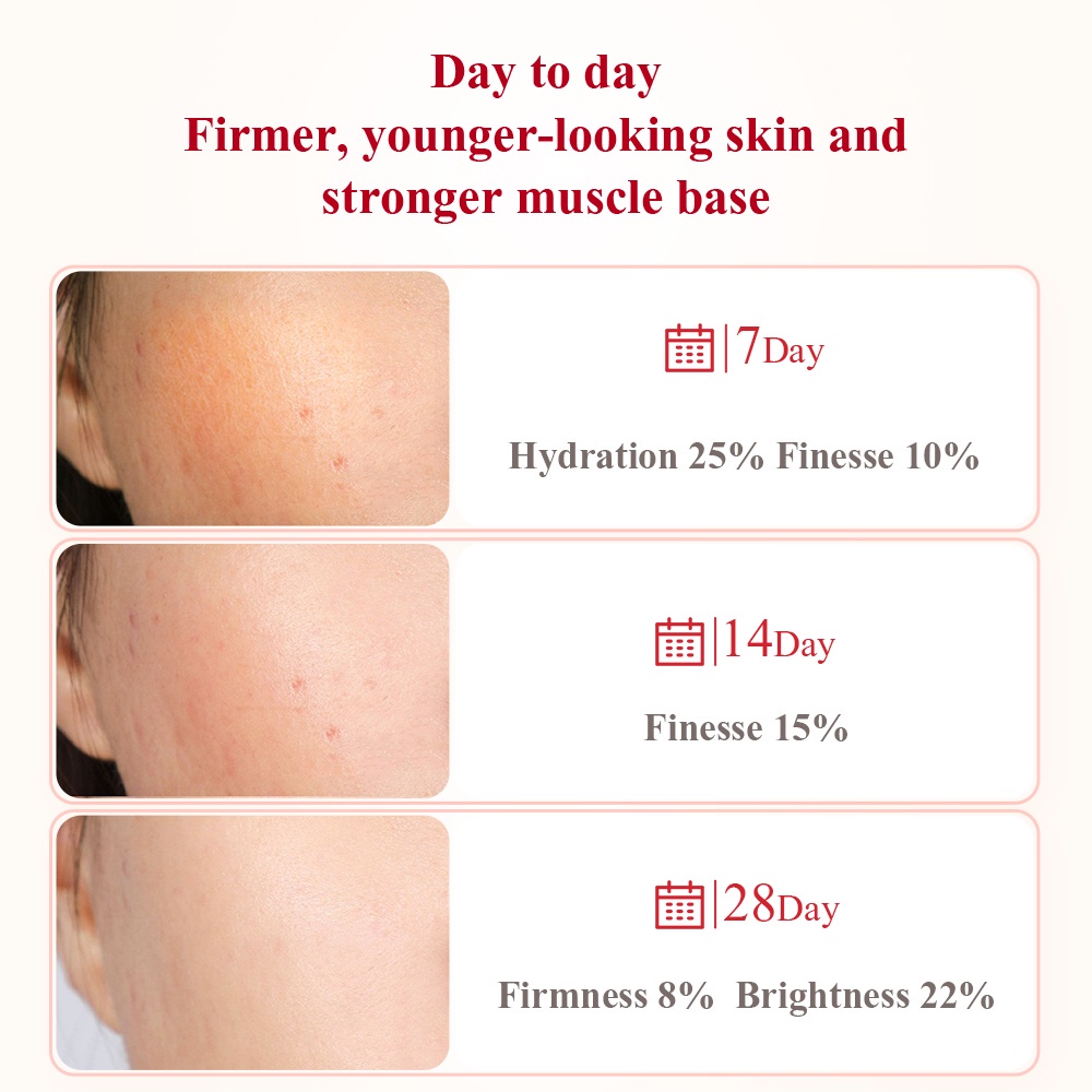 Serum làm trắng da Breylee 30g chiết xuất hạt lựu đỏ dưỡng ẩm tốt