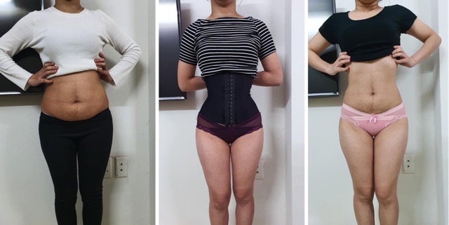 Đai nịt bụng latex 25 xương chuẩn Hy Lạp [ Tặng thước dây] | BigBuy360 - bigbuy360.vn