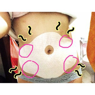 Miếng dán tan mỡ bụng Wonder Patch