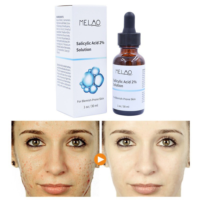 Tinh chất Melao Salicylic Acid 2% dưỡng ẩm se khít lỗ chân lông tẩy tế bào chết chăm sóc da hiệu quả 30ml