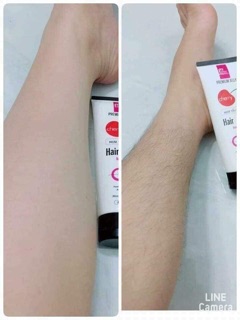 Kem tẩy lông Mwhite