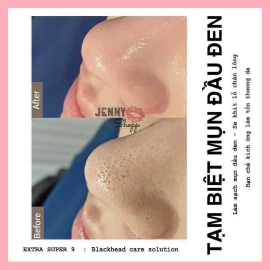 Dung Dịch Ủ Mụn MediPeel Super Extra 9 Plus | BigBuy360 - bigbuy360.vn