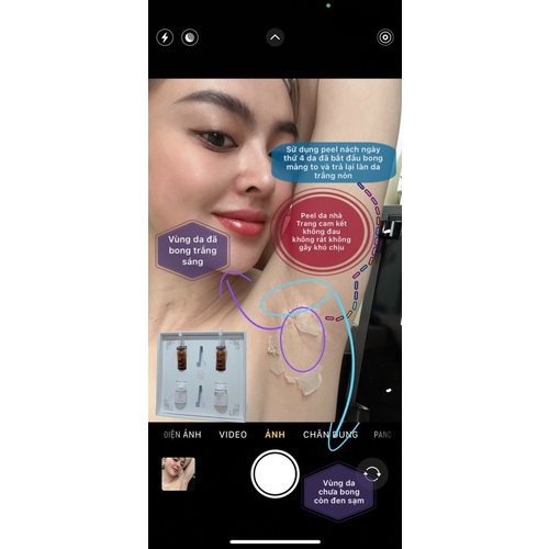 [CHÍNH HÃNG] SERUM PEEL KHỬ THÂM NÁCH , THÂM TI TRANG NEMO | BigBuy360 - bigbuy360.vn