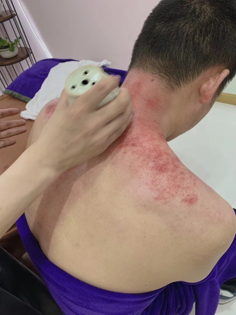Cốc Phù Dương Chấn- Bài Trừ Độc Tố