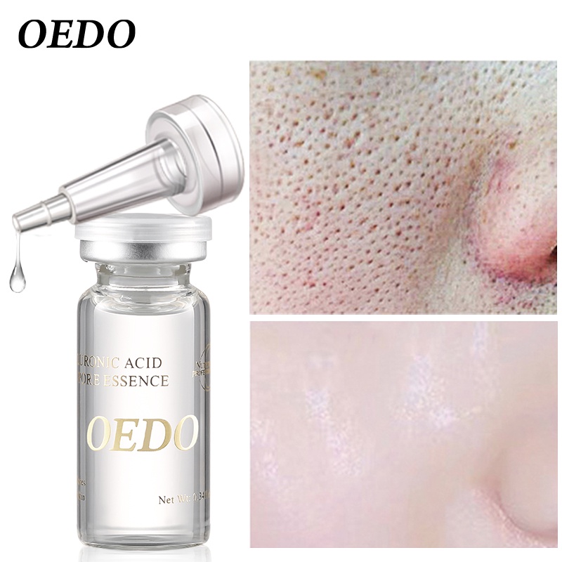 Bộ Sản Phẩm OEDO Sữa Rửa Mặt Dưỡng Ẩm Amino +Mặt nạ vàng+ Tinh Chất Làm Săn Chắc Da +Kem dưỡng trắng da tay+Tinh chất Dưỡng dài mi chất lượng cao