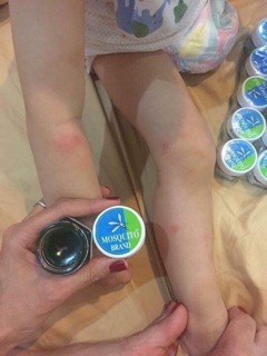 Dầu bôi muỗi cắn