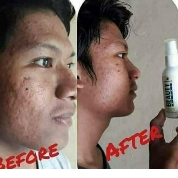 Bình Xịt Làm Đẹp Tự Nhiên 100%EF39 (Trims,.) | BigBuy360 - bigbuy360.vn