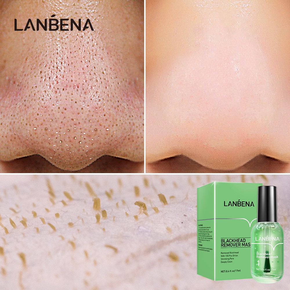 Chai mặt nạ lột mụn đầu đen se khít lỗ chân lông lanbena 17ml kèm 100 miếng dán