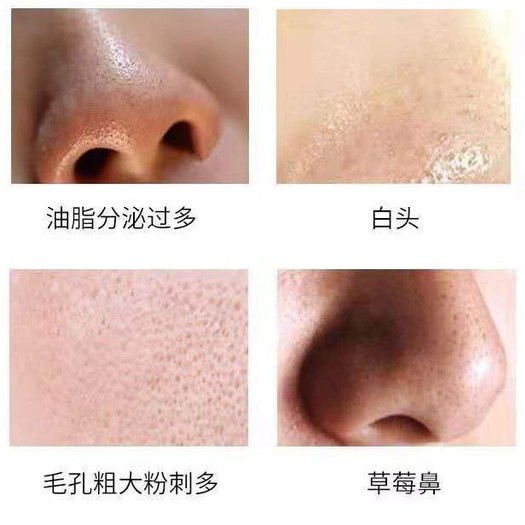 Mặt Nạ Lột Mụn Đầu Đen Vùng Mũi Hiệu REAL STYLE