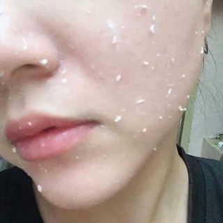 [AUTH CHECK ĐƯỢC CODE] Tẩy da chết Arrahan Peeling Gel Hàn Quốc