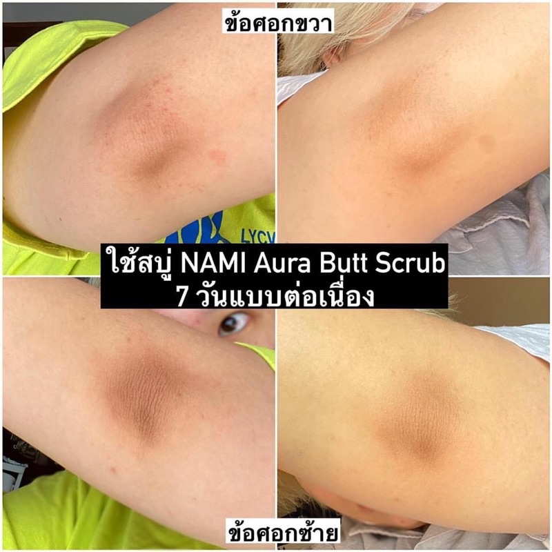 Tẩy tế bào chết xà phòng Nami aura butt gluta-collagen scrub Xà Phòng Thâm Mông,Thâm Nách,Xóa thâm , xóa seo.