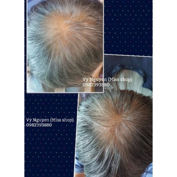 SAMPLE XÀ BÔNG CỤC NGỪA RỤNG TÓC THE SKIN HÀN QUỐC