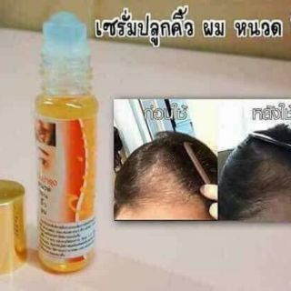Serum kích thích mọc mi,râu,tóc