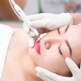 Kim đốt nốt ruồi, đầu đốt thay thế cho máy đốt nốt ruồi