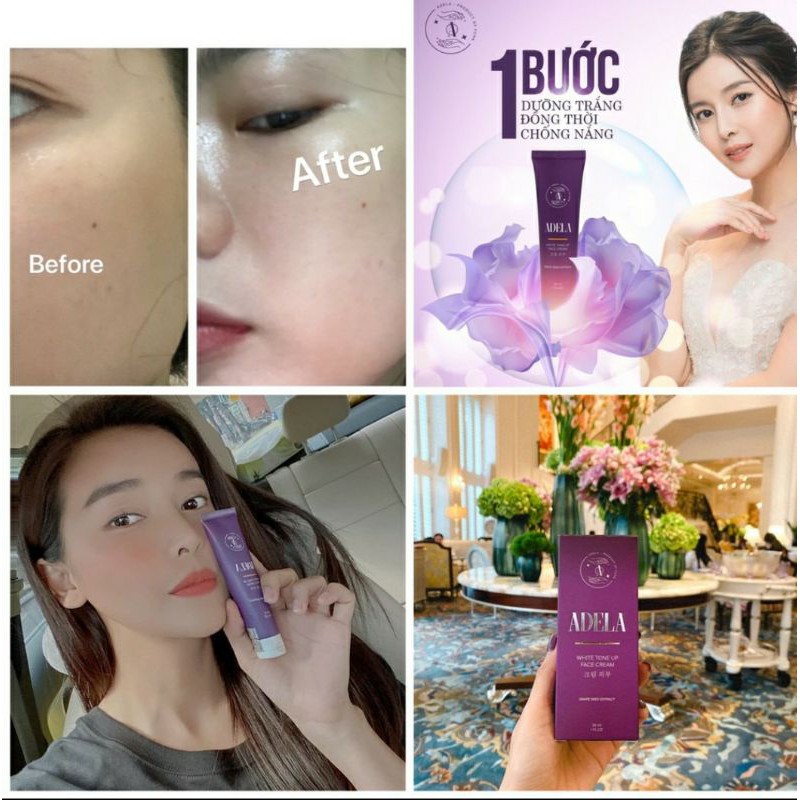 ADELA- Kem Dưỡng Trắng Da Nâng Tone